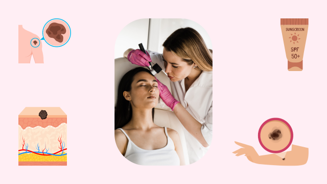 What does skin cancer look like